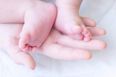 Baby Girl Born “Pregnant” With Twin Fetuses