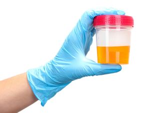 Here’s What The Colour Of Your Urine Says About Your Health