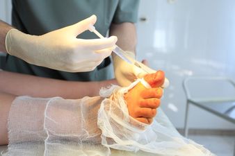 New Cosmetic Surgery Tackles Problem of Fat Toes, “Toe-besity”