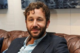 O’Dowd Says He Had “Clown Face” When He Was Younger