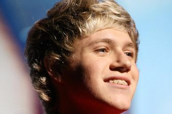 The Messy Pup: Niall Hasn’t Washed Katy’s Lipstick Off