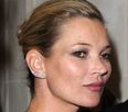 Health Hazard Warning! Copying Kate Moss Could Leave You Bald