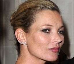 Health Hazard Warning! Copying Kate Moss Could Leave You Bald
