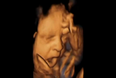 The Most Amazing Piece Of Research: 4D Scan Shows Babies Yawning In The Womb