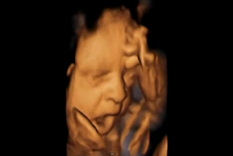 The Most Amazing Piece Of Research: 4D Scan Shows Babies Yawning In The Womb