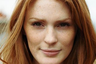 Forget Genetics, Cloud Cover Creates Redheads Apparently