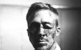 Bruised, Bleeding, Beaten: What Happened To Gosling’s Face?
