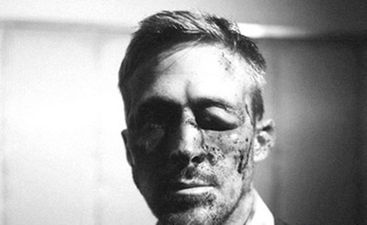 Bruised, Bleeding, Beaten: What Happened To Gosling’s Face?