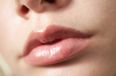 Winter Skin Saviours: Say Goodbye To Flakey Chapped Lips