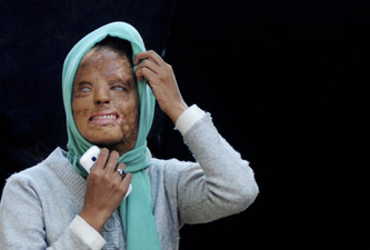 Indian Acid Attack Victim Claims Top Prize in ‘Who Wants to be a Millionaire’
