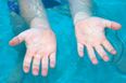 One Of Humanity’s Greatest Questions Answered Today: Why Our Fingers Go Wrinkly In Water…