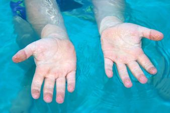 One Of Humanity’s Greatest Questions Answered Today: Why Our Fingers Go Wrinkly In Water…