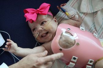 Baby Audrina Goes Home: Miracle Defies Odds As She Is Born With Her Heart Beating Outside Her Body