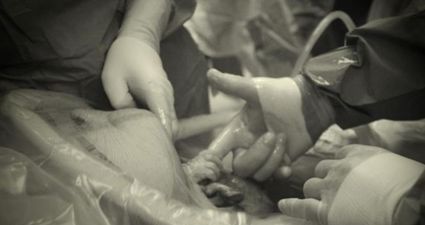 Taking The Web By Storm: One Dad’s Photo Of His Daughter Reaching Out To Touch Doctor’s Hand From Womb