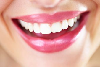 Giv’us A Smile! The Five Foods To Get Your Teeth Gleaming Again