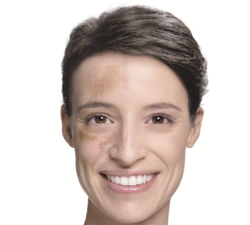 Clear as Day: The Dos & Don’ts of Imperfection Prone Skin