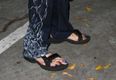 PICTURE – They’re Alive! What The Hell Is Going On With Steven Tyler’s Feet