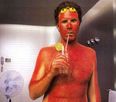 “Trust Me On The Sunscreen” – Twelve Really Unfortunate Cases Of Sunburn