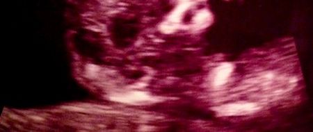 Photo: TV Star and Wife of Jonas Brother Shares Sonogram of New Baby