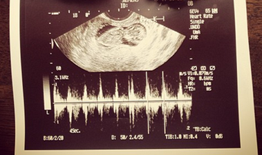 Actress Announces Pregnancy With Sweet Sonogram Snap