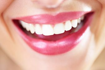 Find Your Smile – Clearbraces.ie Celebrity Apprentice Promotional Day