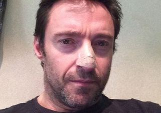 Hollywood Star Hugh Jackman Treated For Skin Cancer
