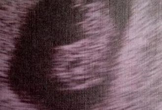 Woww: Reality Star and Fiancé Expecting First Baby