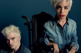 Young Fashion Blogger With Muscular Dystrophy Becomes A Model For Diesel
