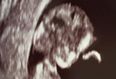 Model Reveals Pregnancy With Sonogram Snap on Twitter