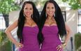 Twins Get Surgery To Look More Alike And Also Share A Boyfriend