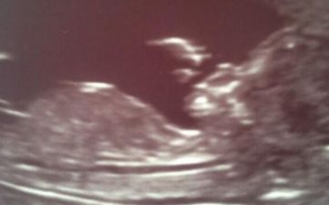 Soap Star Reveals Pregnancy With Sonogram Snap