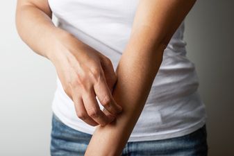 Eczema: everything you need to know about the skin condition