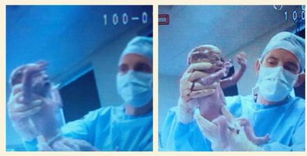 “I’m Now Known as the Quadfather” – Limerick Couple Welcome Quadruplets