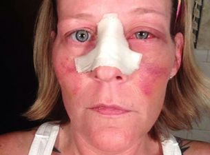 “Does this look like LOVE TO ANYONE OF YOU?” – Woman Posts Shocking Pictures of Domestic Violence to Her Facebook Account