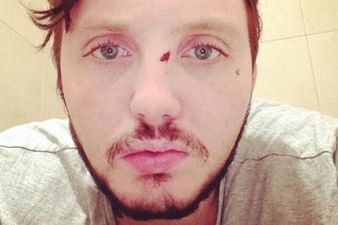 X Factor Star Involved In Bar Brawl In Poland