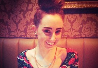 “Why Don’t I Have Boobs Yet? Why Don’t I Have a Straight Body?” Living with Scoliosis – One Young Irish Woman Shares Her Story