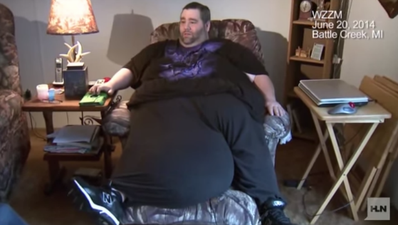 Man With 100lb Scrotum To Have Surgery To Achieve A Smaller Package