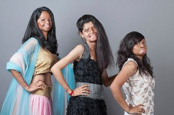 Indian Acid Attack Victims Unite For This Amazing Photoshoot