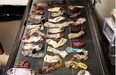 PICTURE: This Is What 43 Socks Inside A Dog’s Stomach Looks Like…