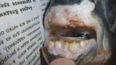 Something’s Biting: Fisherman Pulls A Catch With Human Teeth