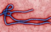 Ebola Case Confirmed In Glasgow