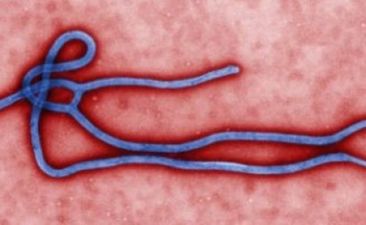 Ebola Case Confirmed In Glasgow