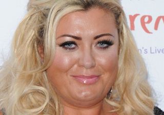 Gemma Collins Allegedly Assaulted by Boyfriend