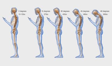 This is What Your Phone Addiction is Doing to Your Spine