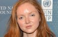 Model Lily Cole Is Expecting Her First Child