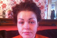 Woman Left With Four Eyebrows After Cosmetic Tattoo Went Wrong