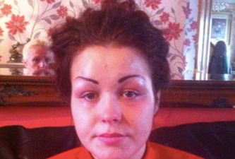 Woman Left With Four Eyebrows After Cosmetic Tattoo Went Wrong