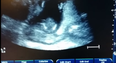 WATCH: This Baby Can Clap Along To Music In The Womb…