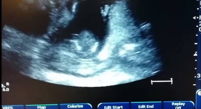 WATCH: This Baby Can Clap Along To Music In The Womb…