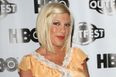 Tori Spelling Undergoes Skin Graft After Being Rushed To Hospital With Severe Burns